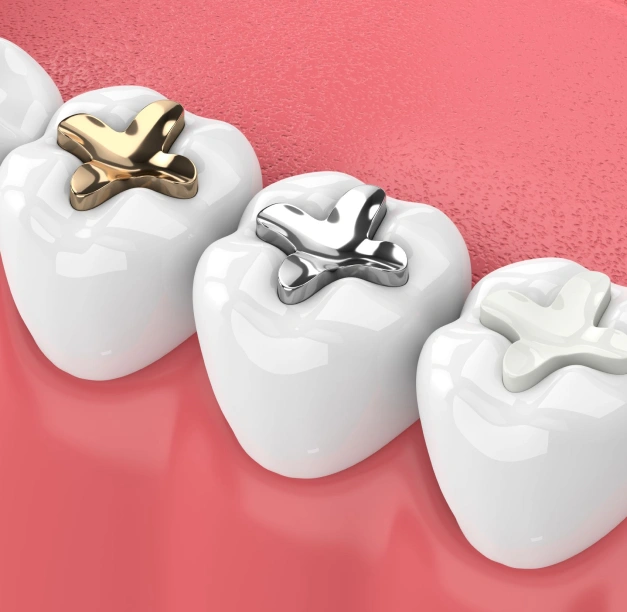 Three white tooth models showing different dental bracket options against pink background.