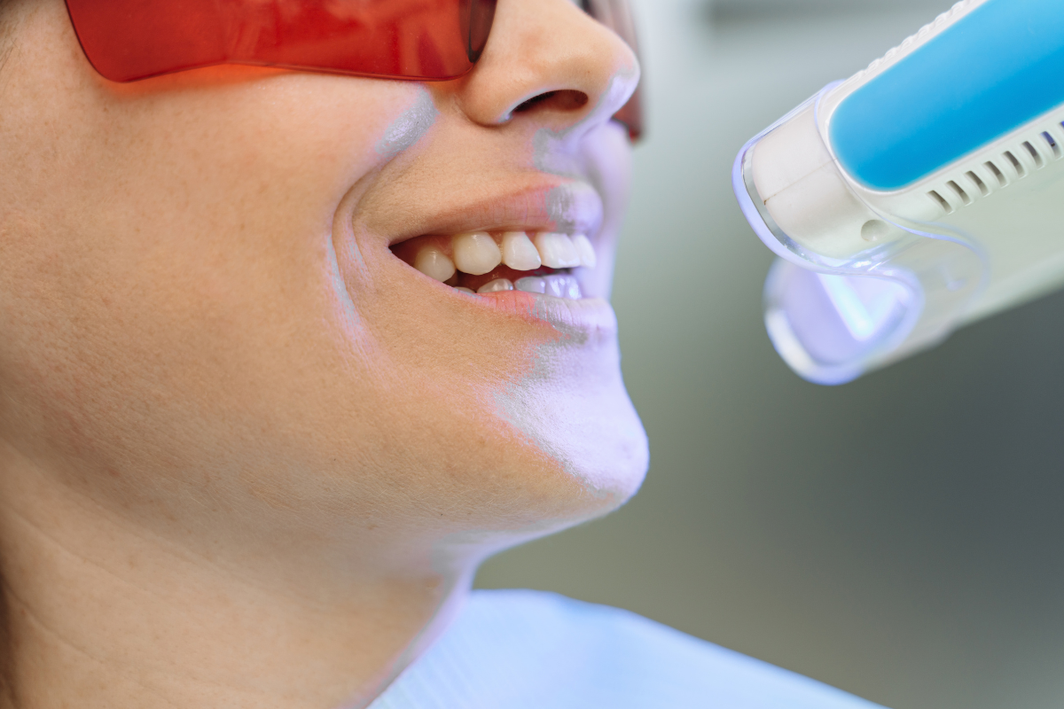 Professional Teeth Whitening process